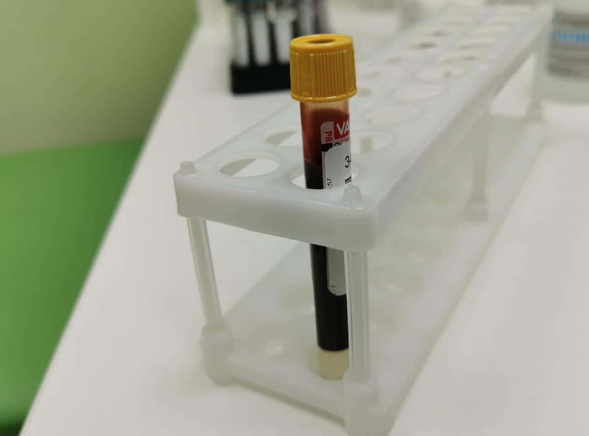 В детском саду Тагила заподозрили кишечную инфекцию