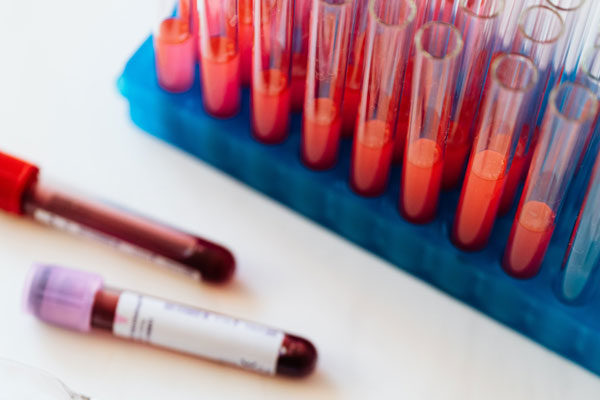 На Среднем Урале зарегистрировано 166 новых случаев COVID-19. +16 в Тагиле