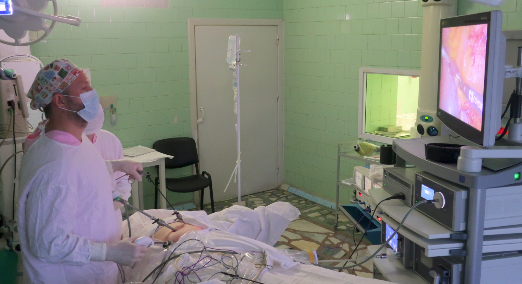 Врачи Свердловской областной клинической больницы №1 впервые реконструировали пищевод из желудка малотравматичным методом Врачи Свердловской областной клинической больницы №1 впервые реконструировали пищевод из желудка малотравматичным методом