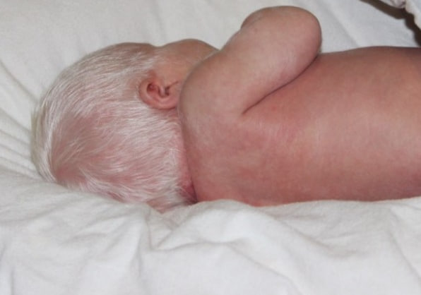 Уникальное рождение в Нижнем Тагиле: на свет появился мальчик-альбинос с весом 4550 граммов | В Нижнем Тагиле родился мальчик-альбинос с уникальной внешностью